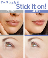 Vilvin microdart patches on forehead for gentle overnight treatment