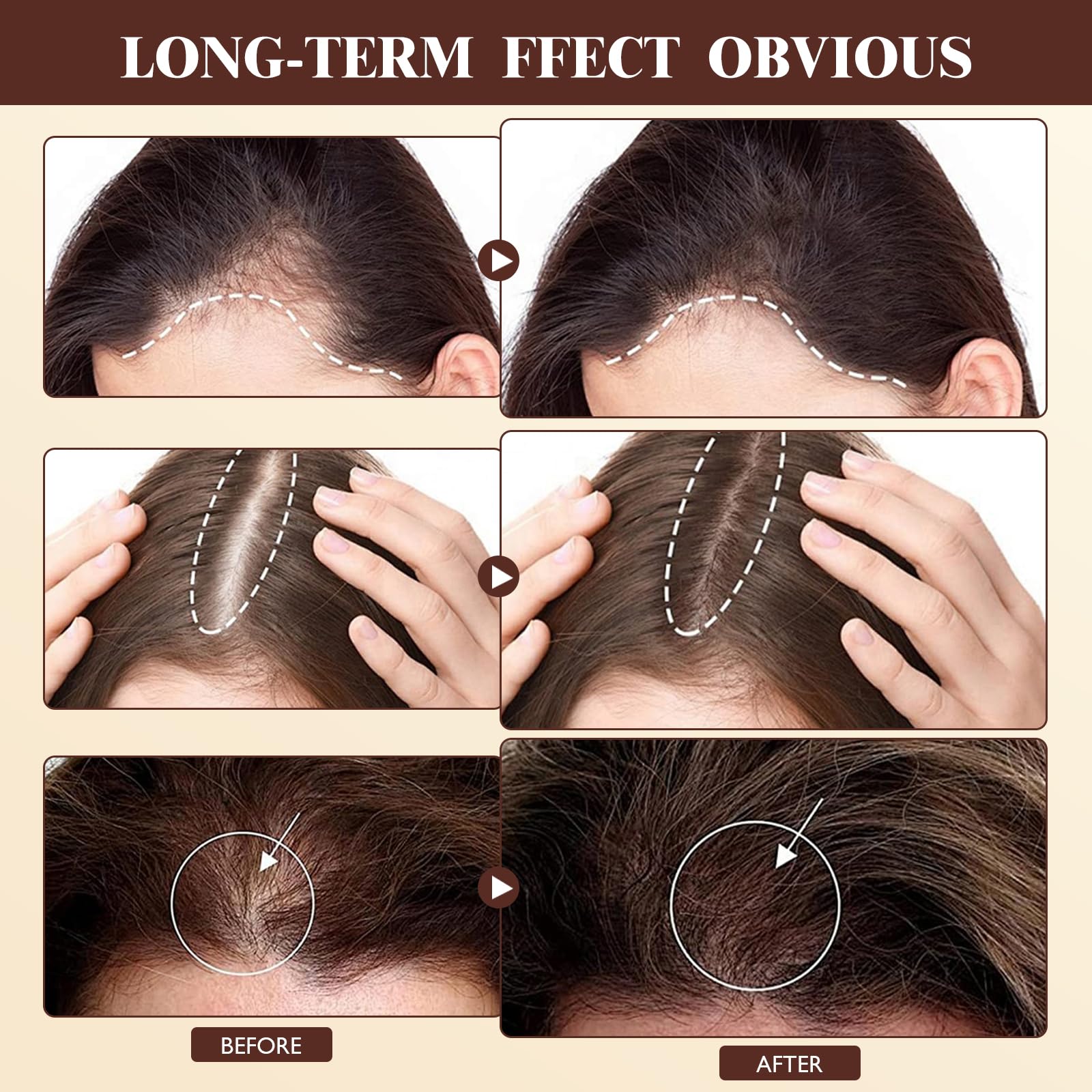 Vincofoo Hair Growth Spray complements daily hair-care routines