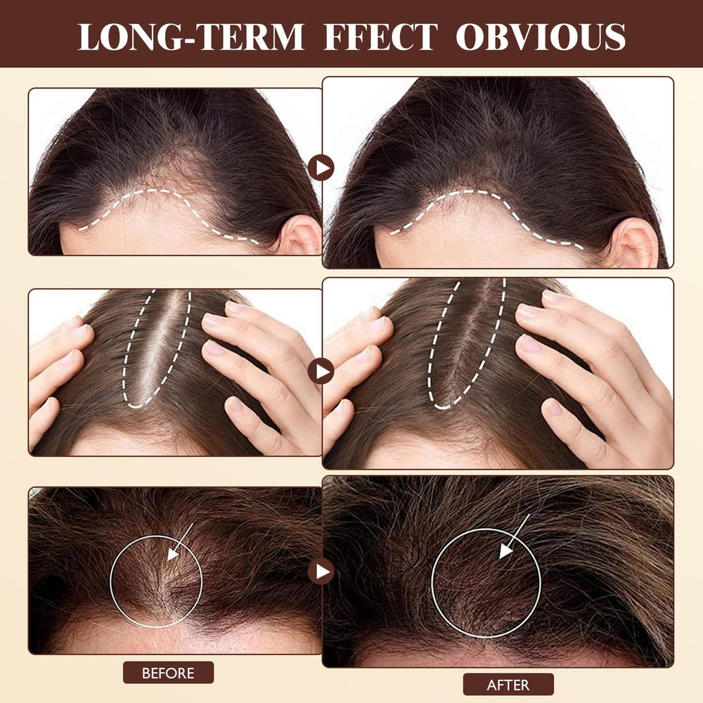 Vincofoo Hair Growth Spray complements daily hair-care routines