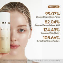 VINNE Signature Milky Foam Cleanser foaming texture delivers a refreshing cleanse.