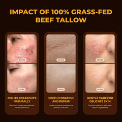 VIORY balm ingredients include grass-fed tallow and raw honey for nourishment.