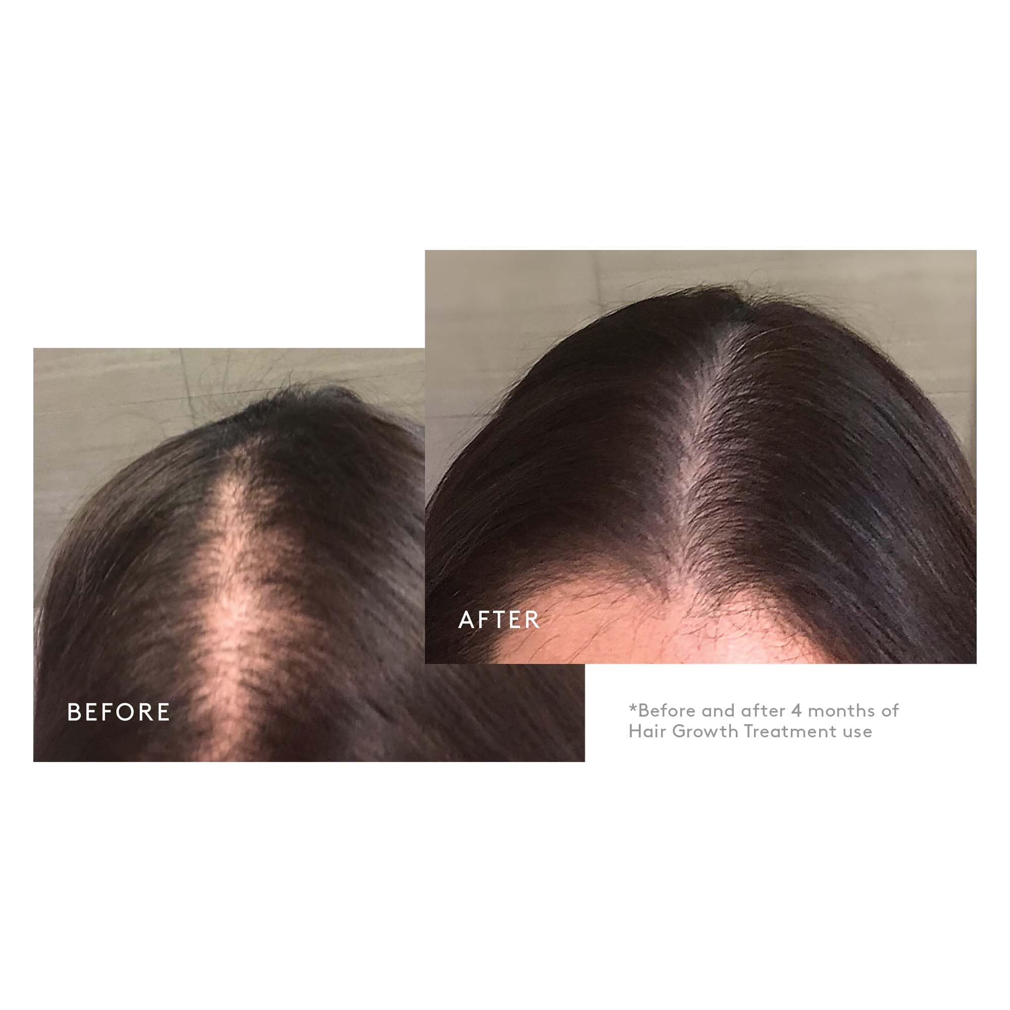 Virtue alpha gamma keratin ingredients label shows strengthening protein components