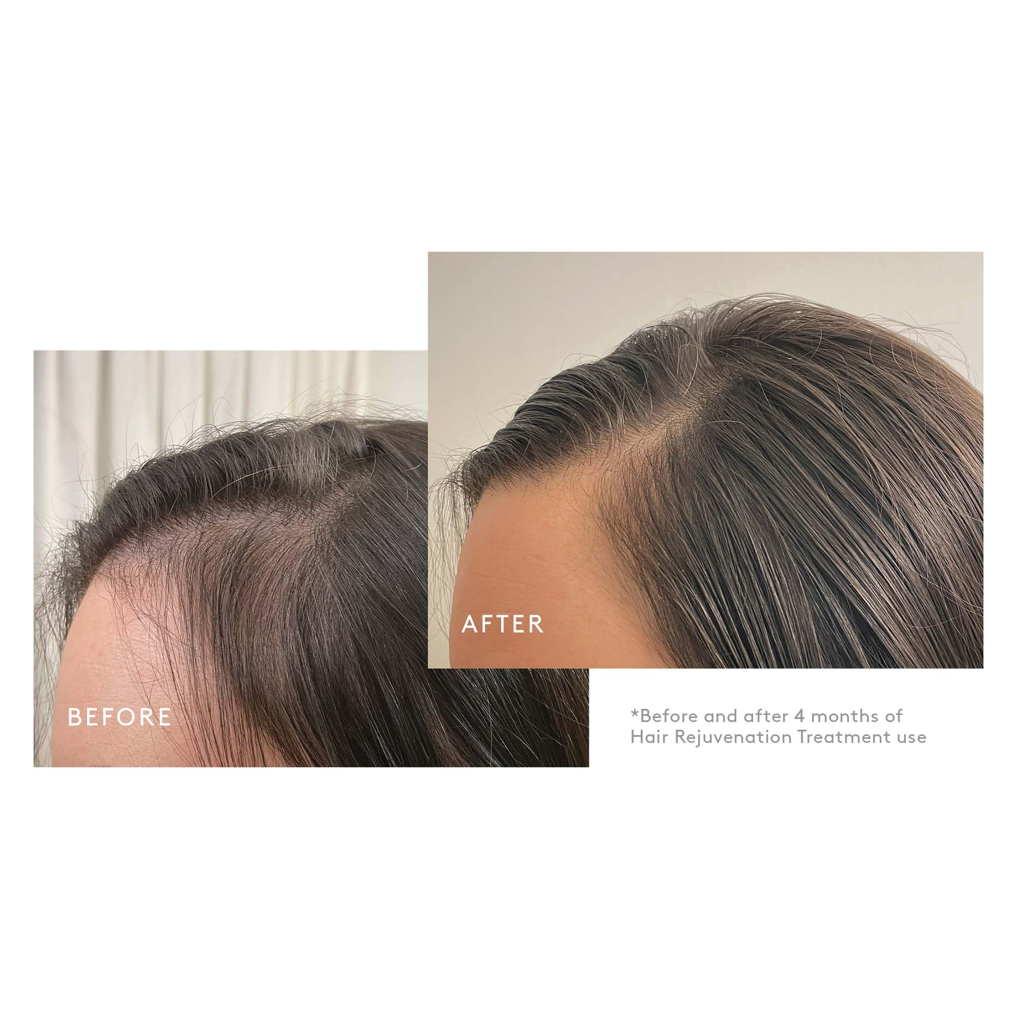 Virtue Density Booster application on scalp during routine care.