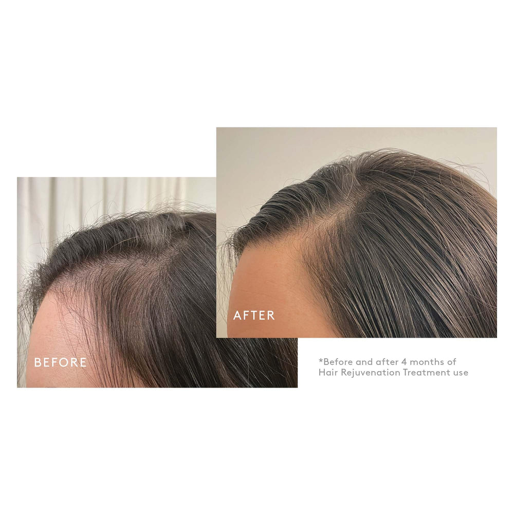 Virtue Density Booster application on scalp during routine care.