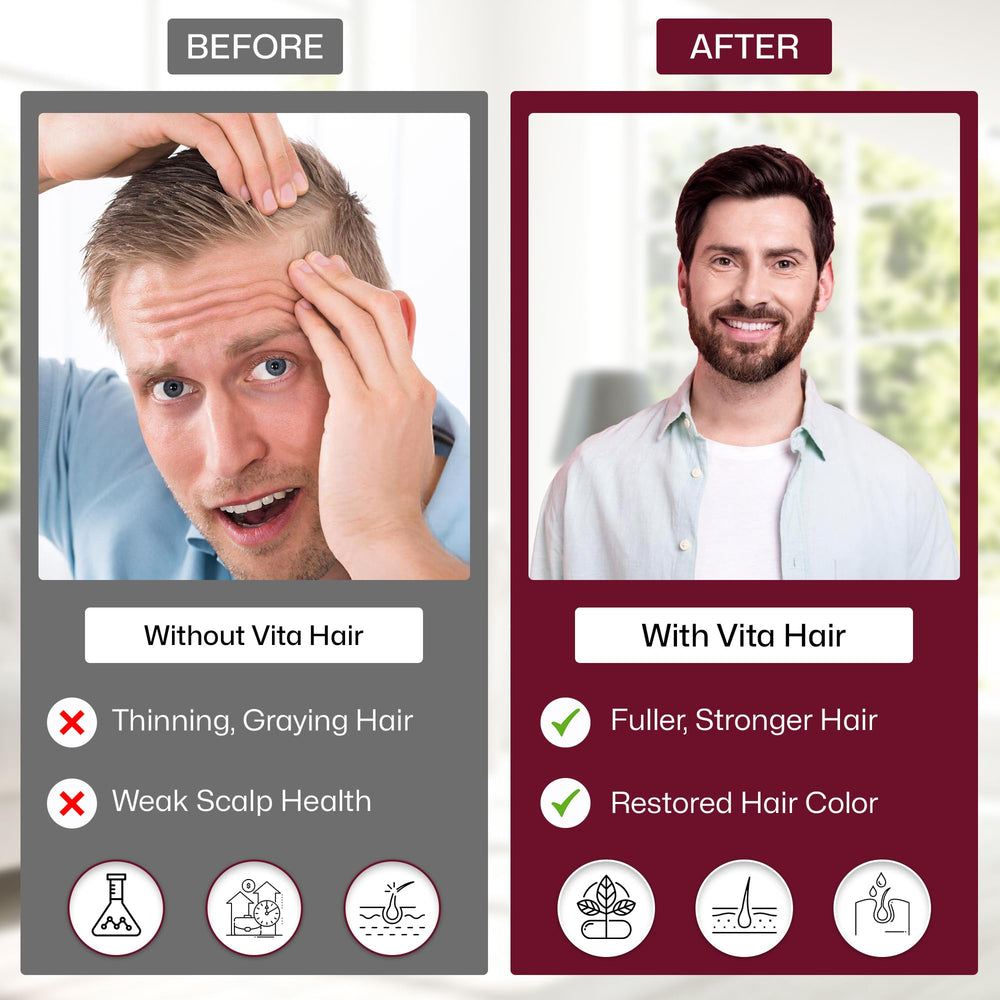 Vita Hair packaging and dosing cap for easy daily regimen.