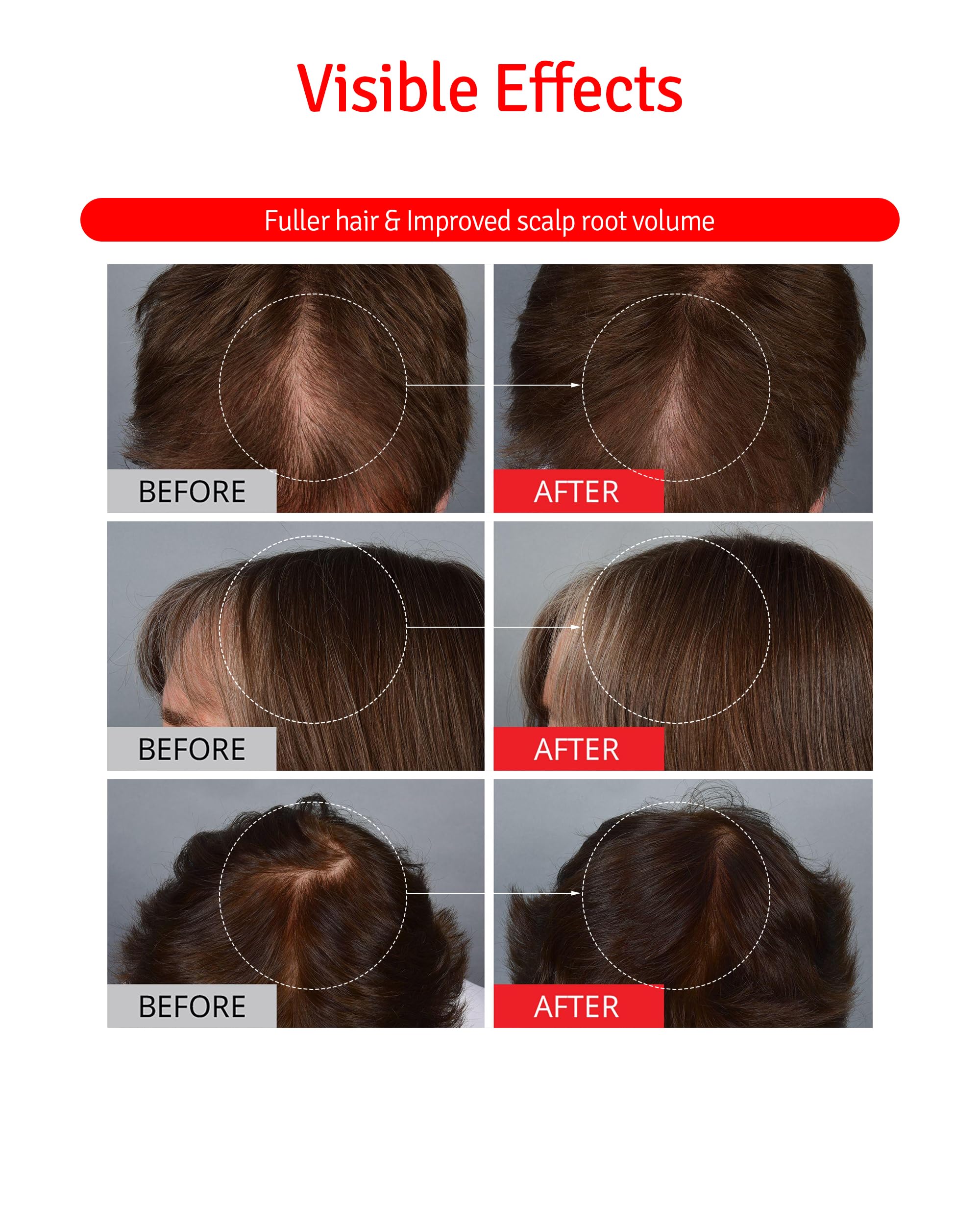 Hair strands with added volume after using Vitabrid C12.