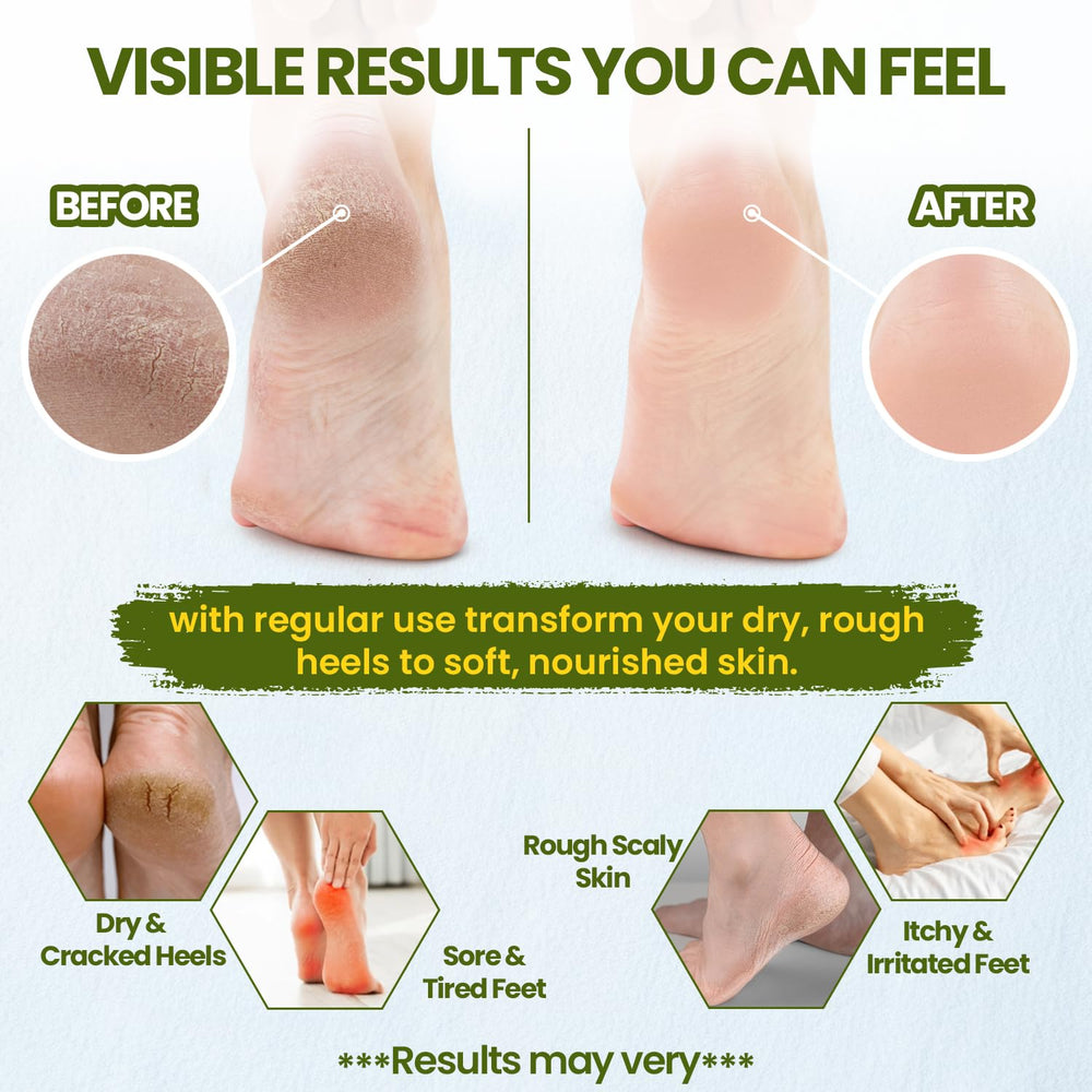 Vital Affair Tea Tree Oil Balm underarms keeps skin comfortable during activity.