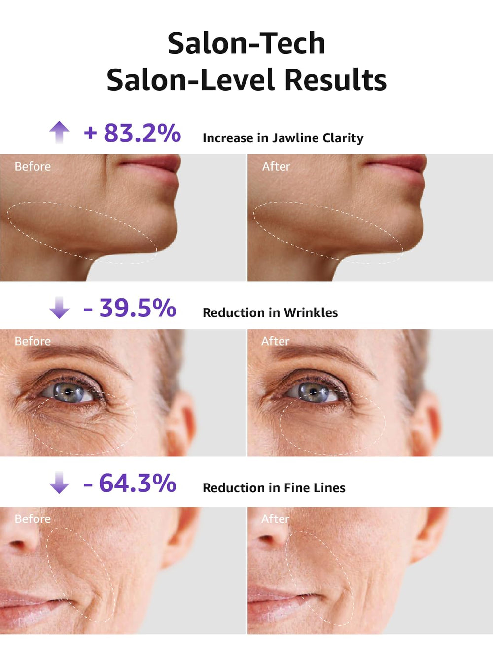 VITALY Glow Pro 3-in-1 function illustrates microcurrent and light therapy