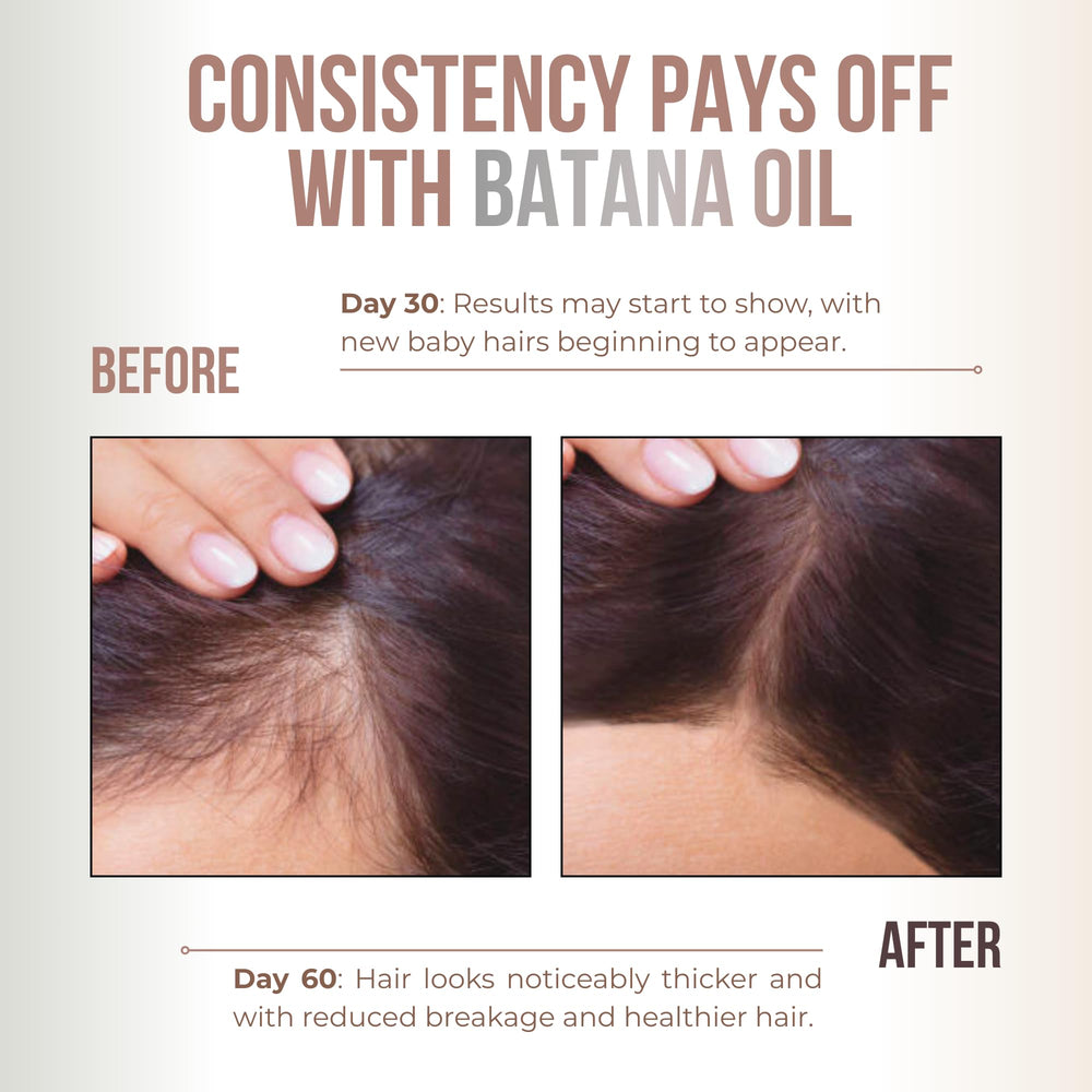 Vitamo Batana Oil liquid glistening demonstrates lightweight hydration for all hair types