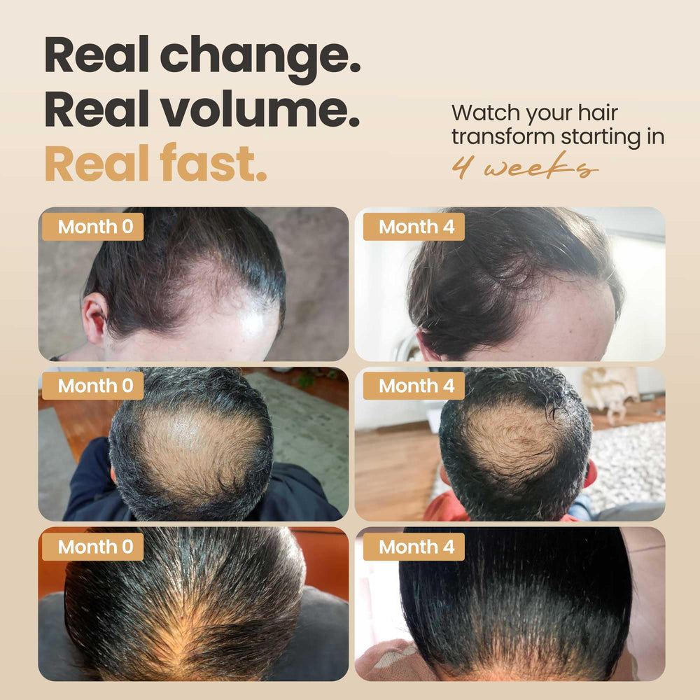 Vitasei Hair Booster ingredients closeup highlighting Capilia Longa and olive stem cells.