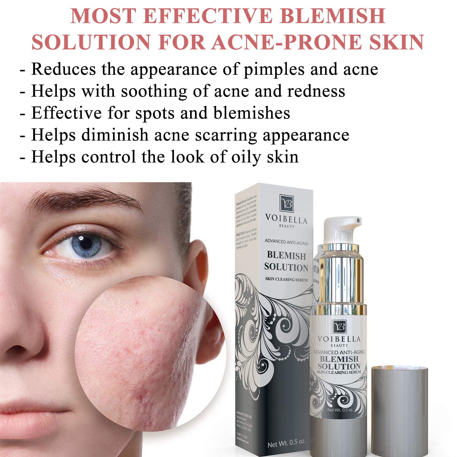 Voibella Beauty blemish spot serum packaging box highlights gentle acne care.