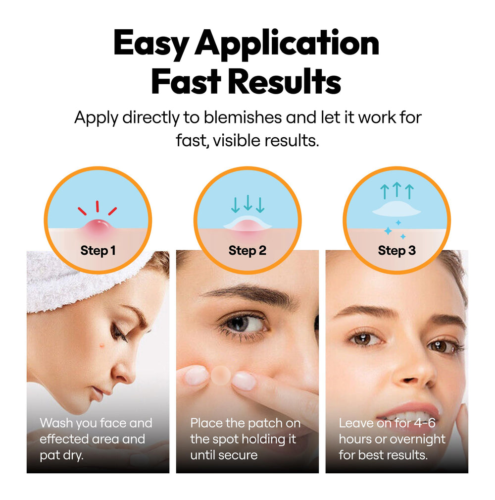 Vonessence patches on skin during day provide discreet blemish care