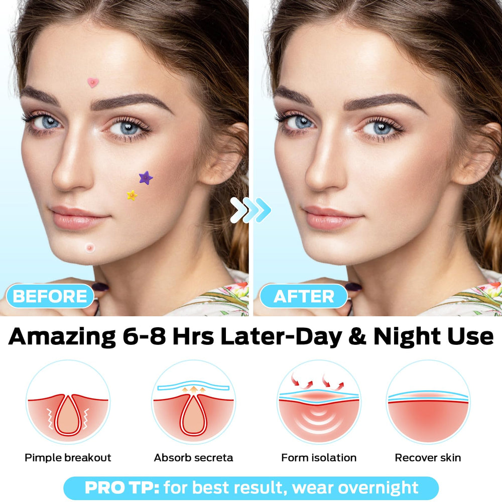 VOZRO six-color set for discreet zit concealment