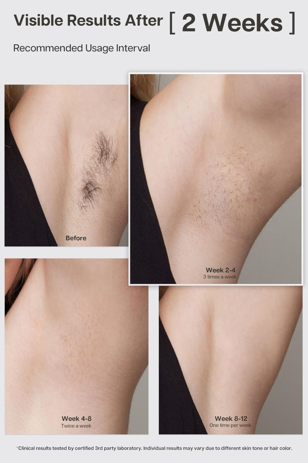 VRAIKO Lyra ice-cooling sapphire contact provides comfortable hair removal.