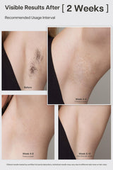 VRAIKO Lyra ice-cooling sapphire contact provides comfortable hair removal.