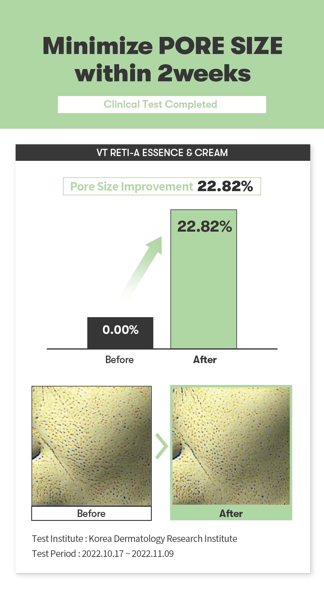 VT COSMETICS Cica Reti-A Cream on a spot area provides targeted care