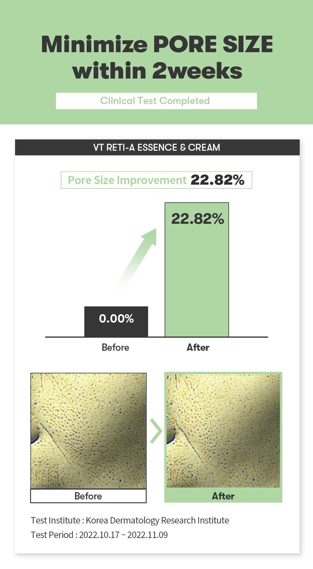 VT COSMETICS Cica Reti-A Cream on a spot area provides targeted care