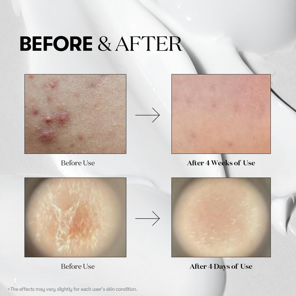 VT COSMETICS Reedle Shot 300 vial supports deeper absorption in skincare routine.