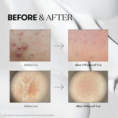 VT COSMETICS Reedle Shot 300 vial supports deeper absorption in skincare routine.