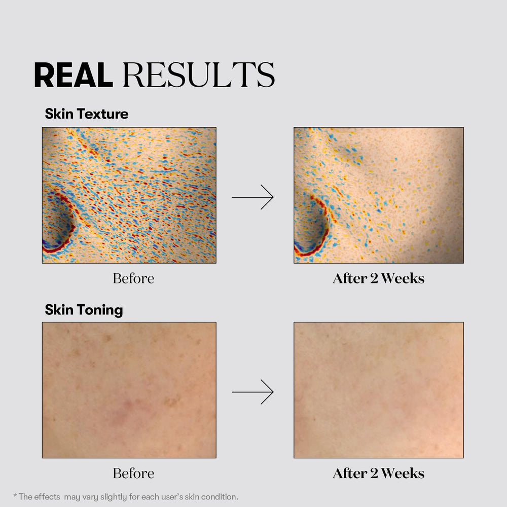 VT COSMETICS TX Toning Daily Mask ingredients-panel highlights Tranexamic Acid and Niacinamide benefits.