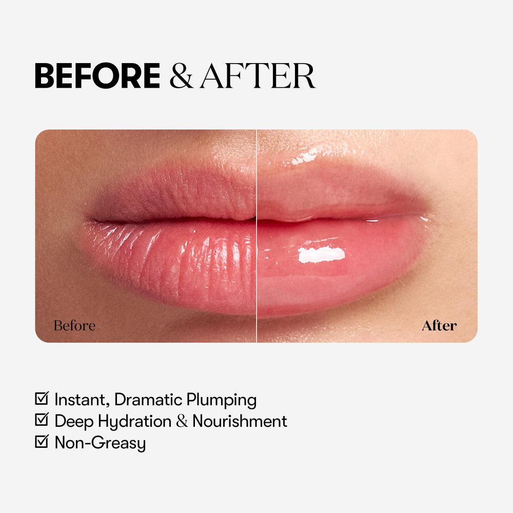 VT COSMETICS Reedle Shot Lip Plumper Hyaluronic acid ingredients for hydration.
