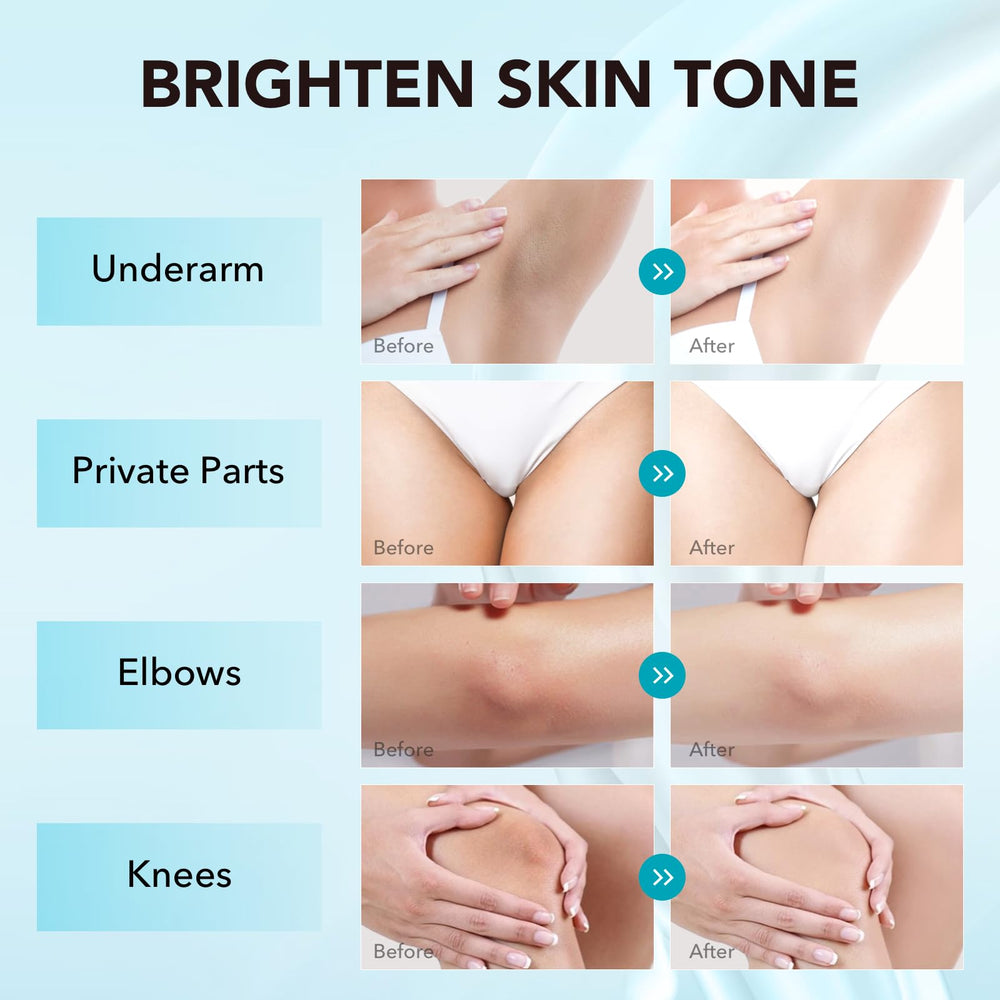 VZP Dark Spot Remover elbows bottle targeting pigmentation with smooth application.