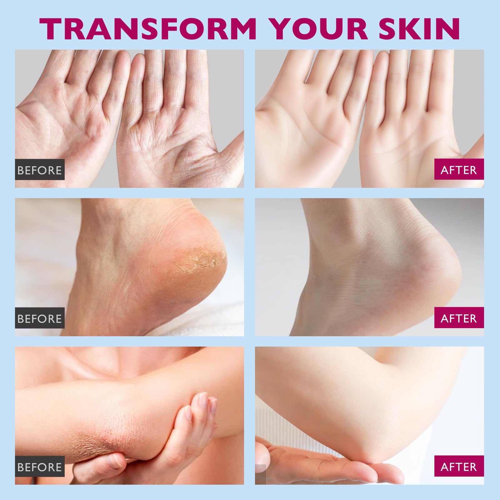 VZP Frankincense Essential Oil Cream elbows heels nourishment during winter dryness.