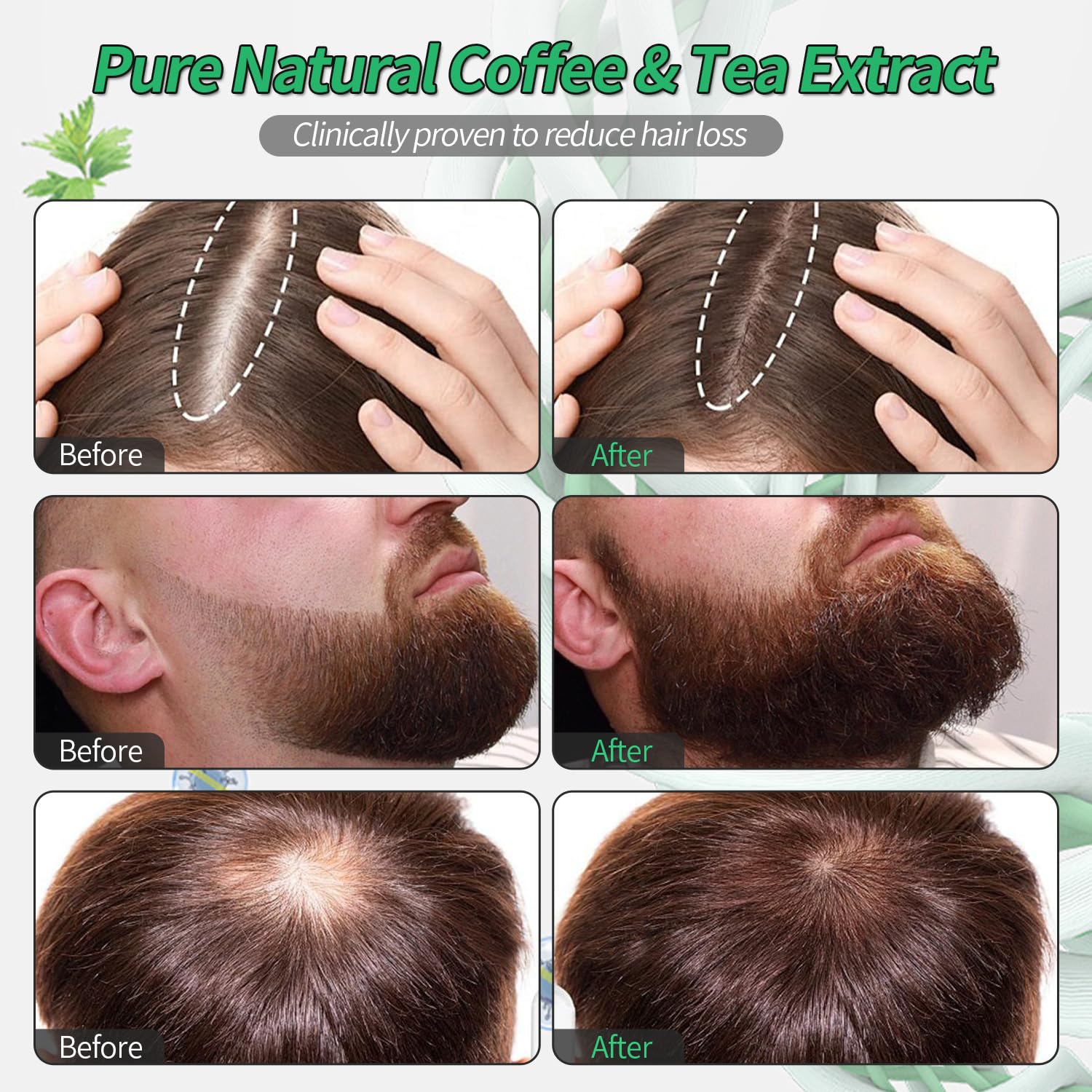 W3W Orrenaturals Amber bottle of hair growth serum ready for daily use.