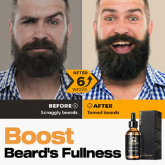 Waking Forest beard oil castor seed detail suggesting fuller-looking beard effect.