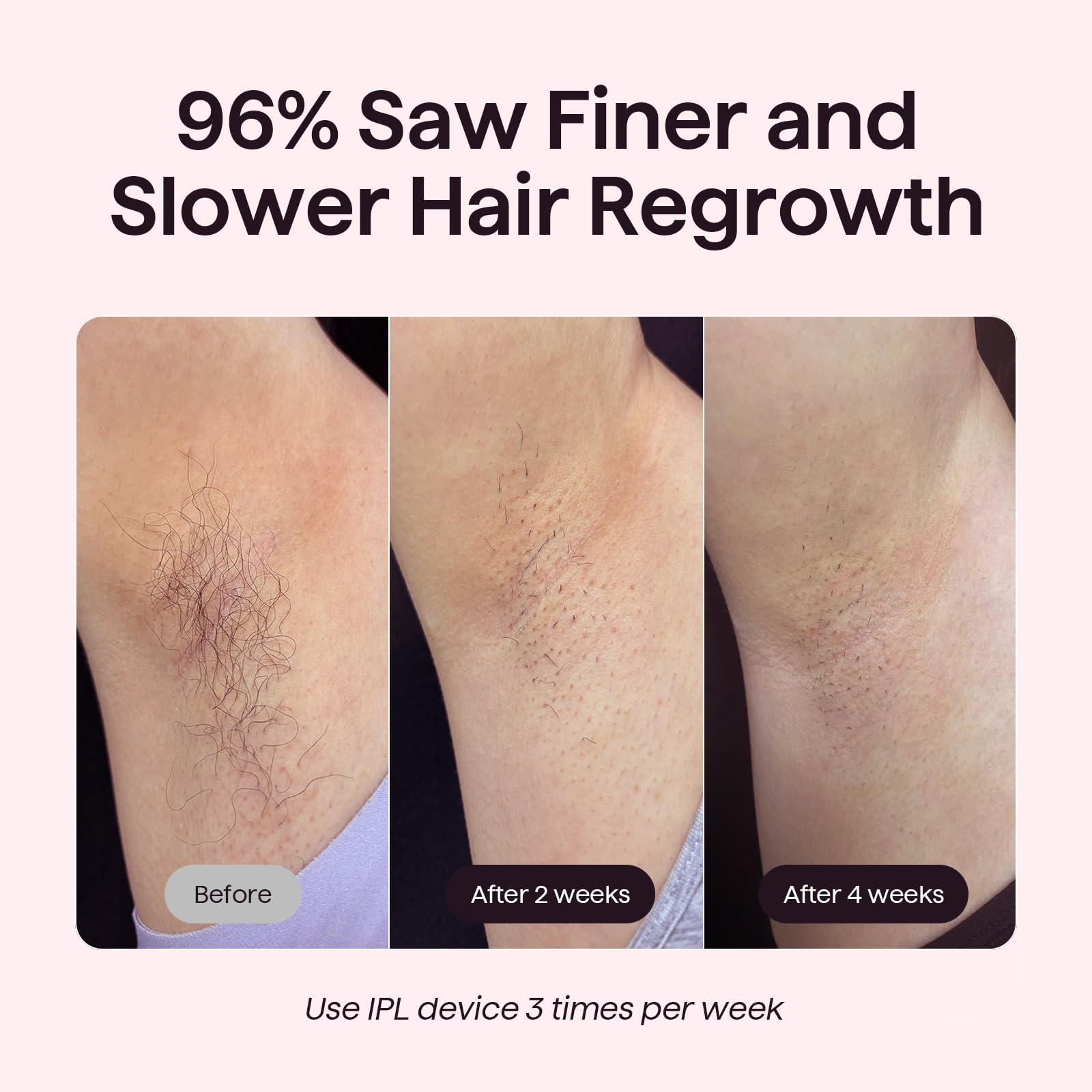 Wavytalk Bare It bikini mode for precise, comfortable bikini-area hair removal