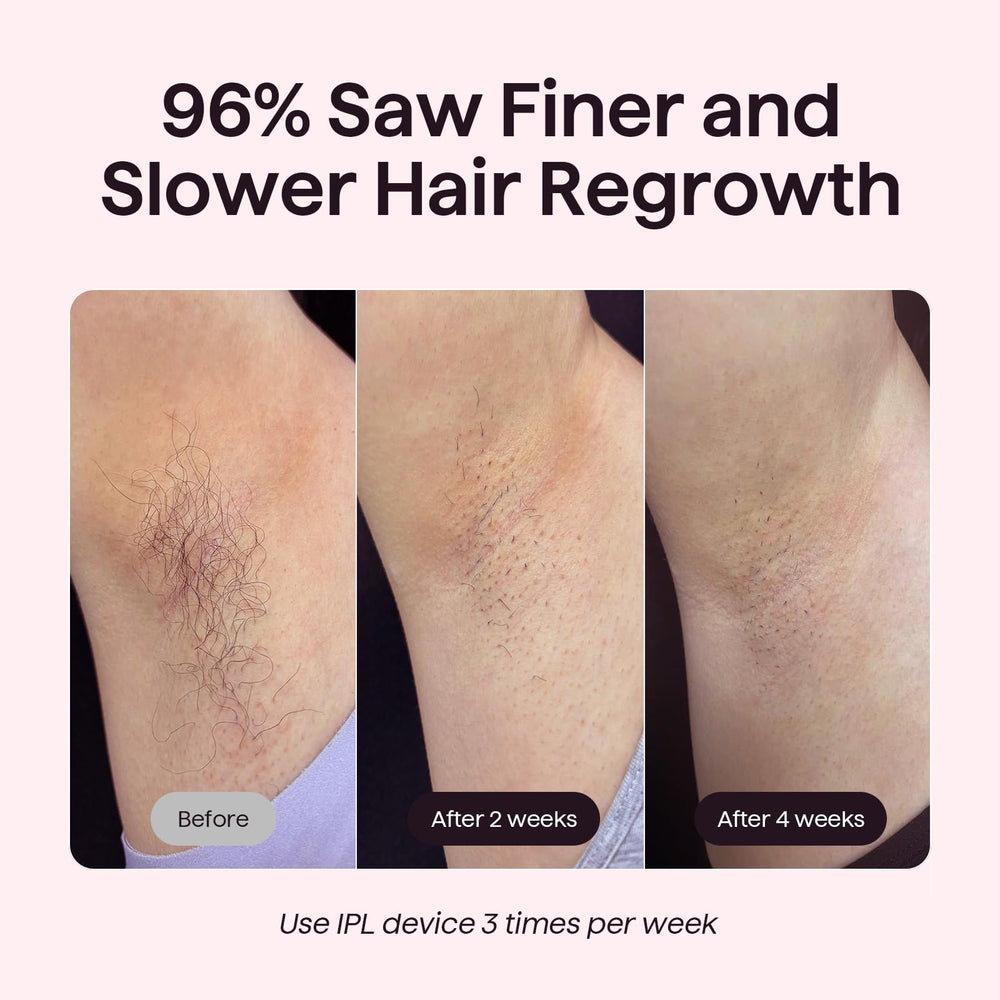 Wavytalk Bare It bikini mode for precise, comfortable bikini-area hair removal