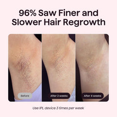 Wavytalk Bare It bikini mode for precise, comfortable bikini-area hair removal