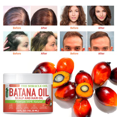 Wealthskin Batana Oil bottle for scalp massage nourishes roots and scalp.