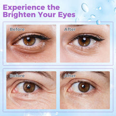 WEAUUP eye cream with retinol and peptides promoting gentle firmness around eyes