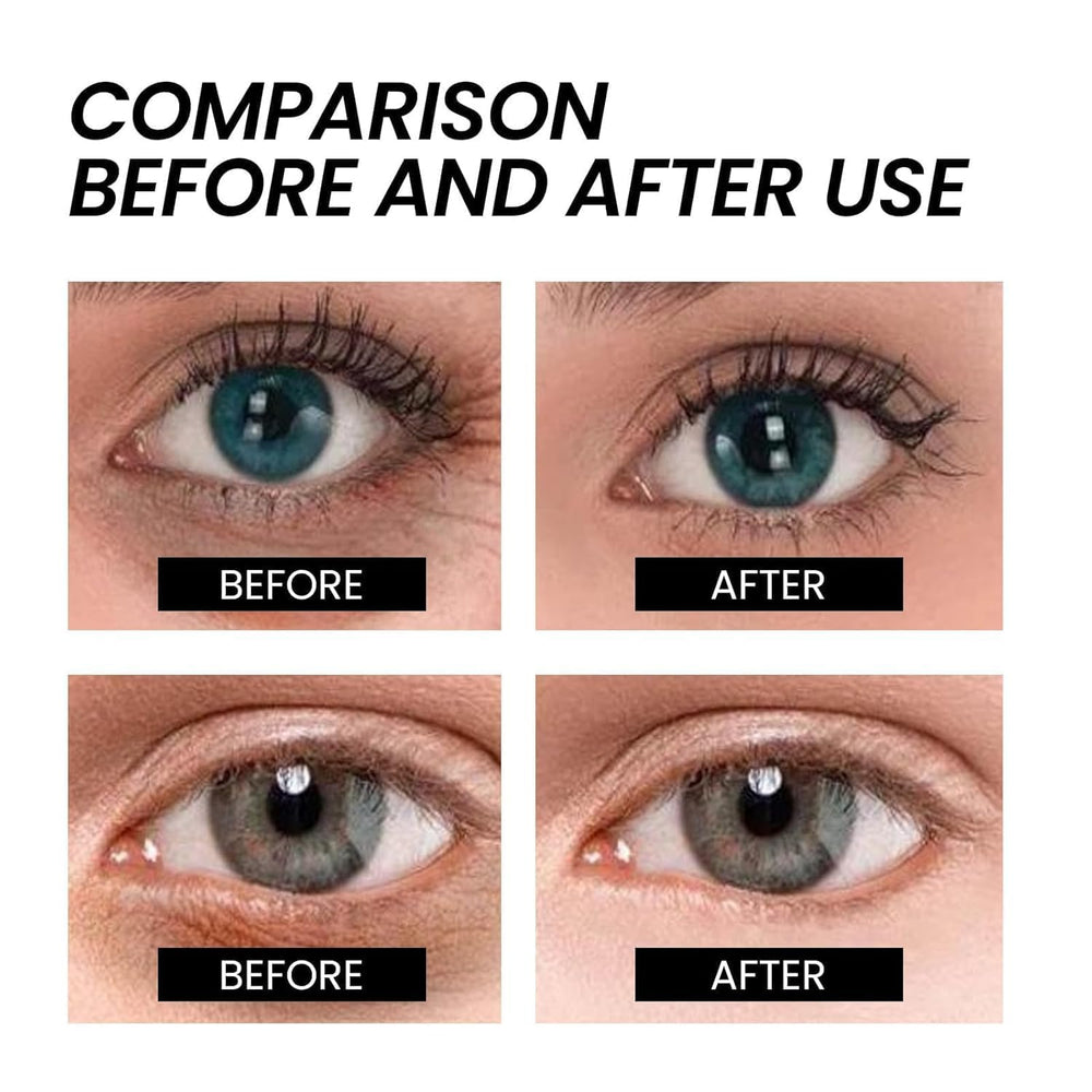 Night-time application of Weslaplus Naturals eye cream on the delicate eye area