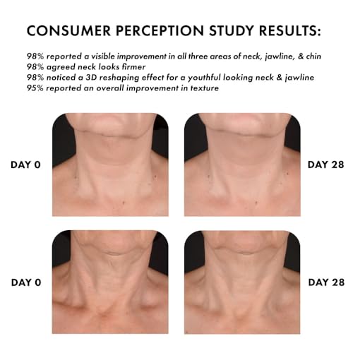 Whish Neck Firming Cream neck-application scene suggesting smoothing of lines.