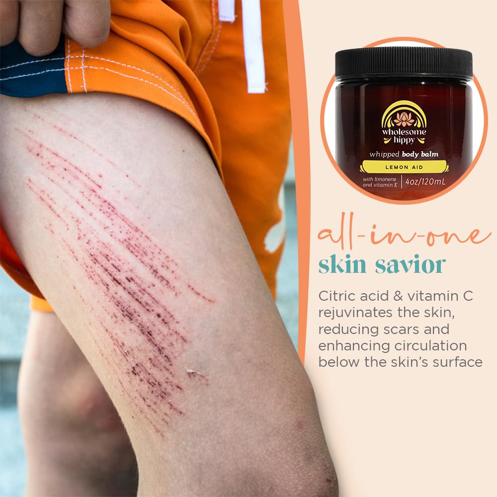 Wholesome Hippy Lemon-Aid Balm hands-use shot demonstrates versatile care for cuticles and dry patches.