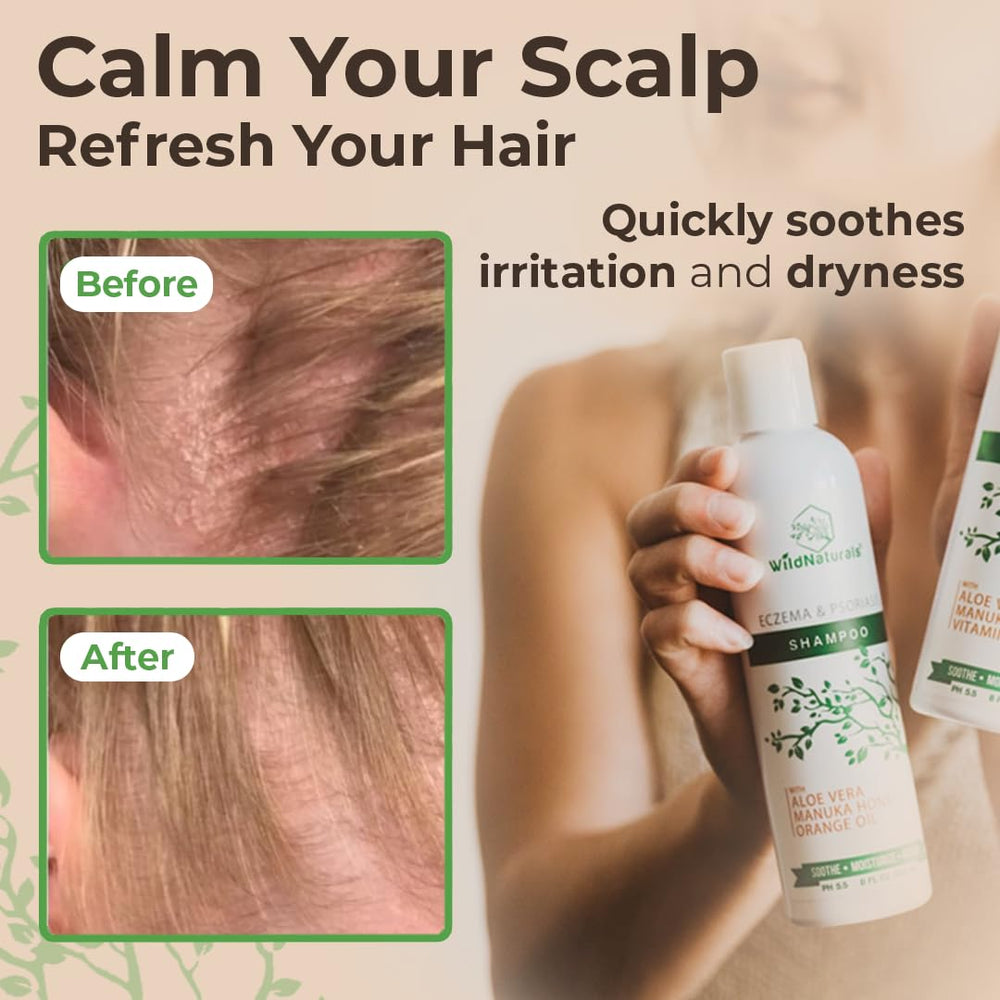 Wild Naturals eczema shampoo close-up of key ingredients Manuka honey and Aloe Vera