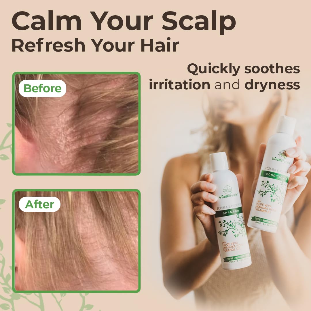Wild Naturals aloe vera base shampoo graphic emphasizes gentle, water-free formula