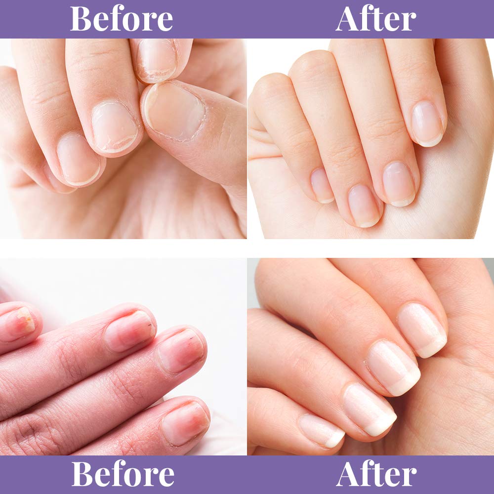 Winning Nails Buffing Cream supports healthy nail bed circulation