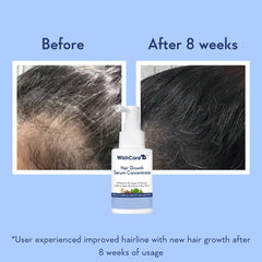 WishCare Hair Growth Serum Rice Water base for lightweight feel