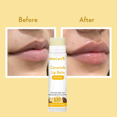 WishCare Lip Balm with Niacinamide nourishes and smooths lips.