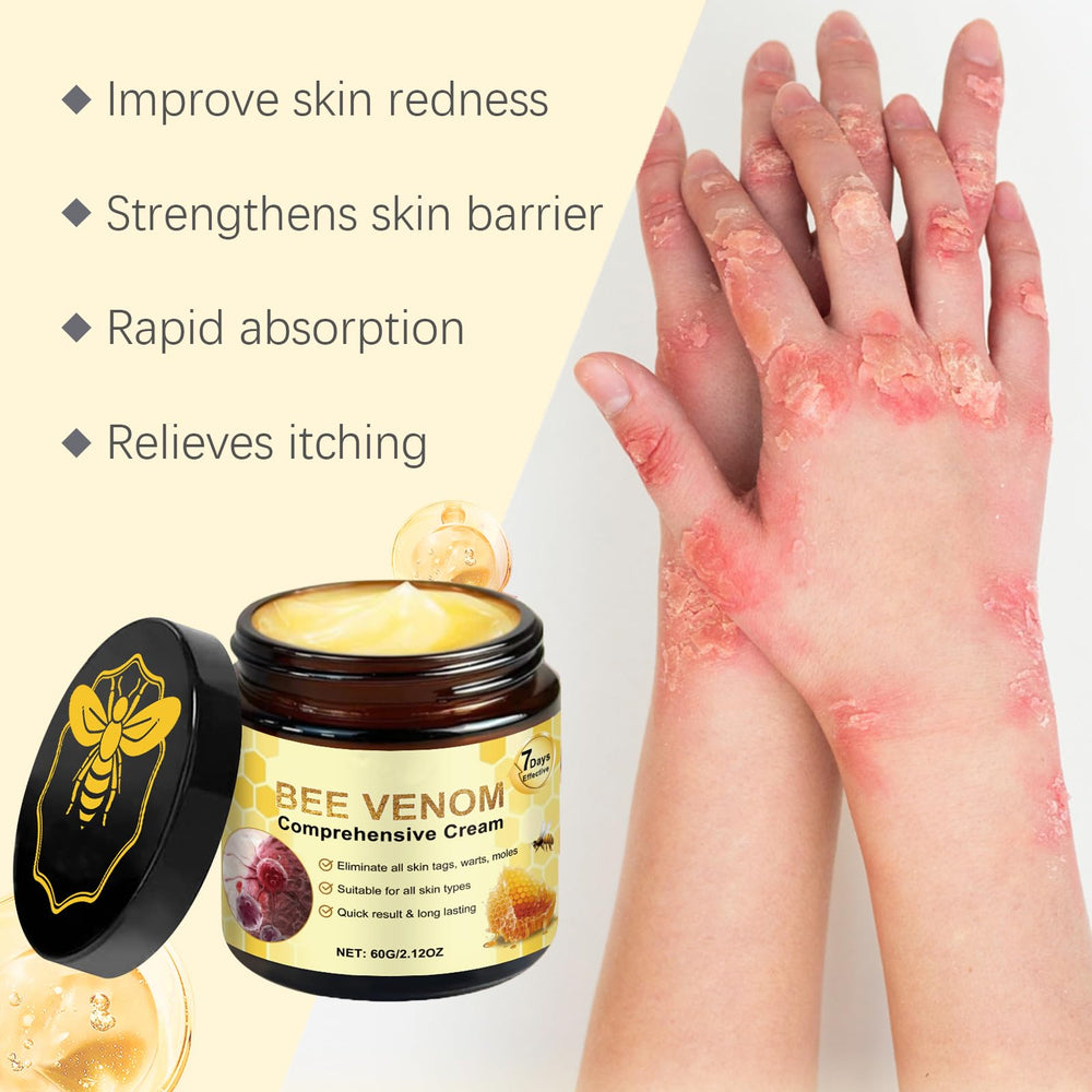 Wlecoso Bee Venom Cream packaging box ready for gifting and daily care.