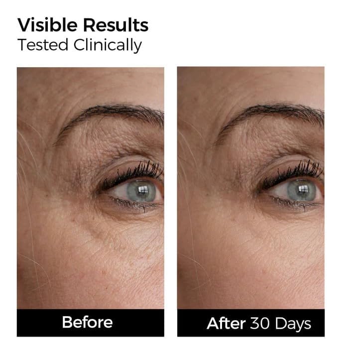 WNP 4D hyaluronic acid texture close-up demonstrating deep hydration penetration.