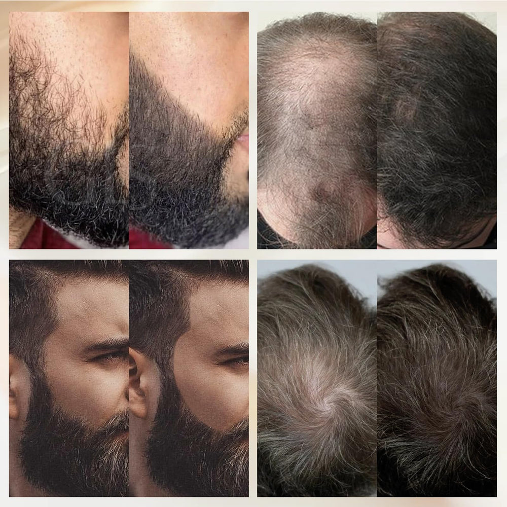 WOZUTUNT safe beard fiber formula suitable for all beard types