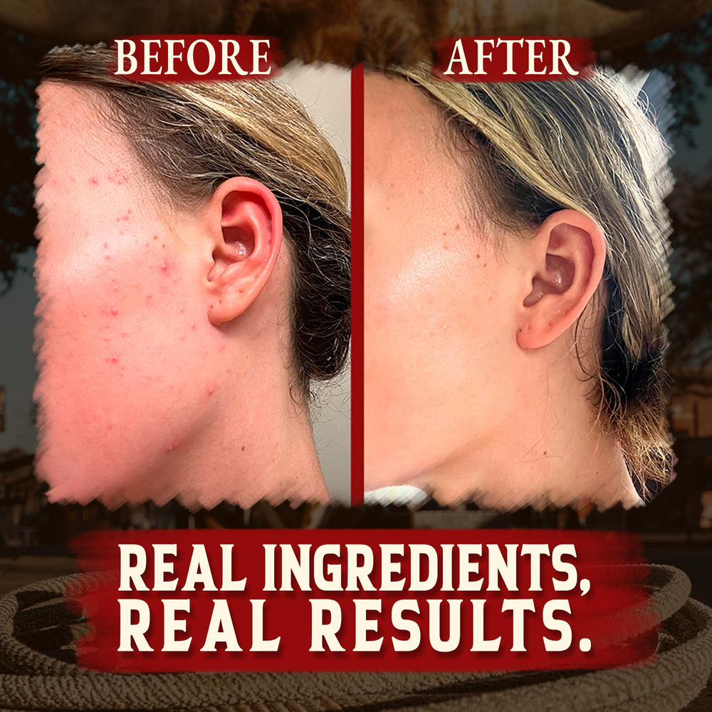 Wrath & Remedy honey and tallow application on hand demonstrates easy daily moisturization.