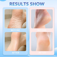 XICOFISS Anti crack stick combines exfoliation and moisturization in one easy application.