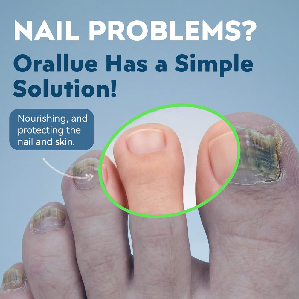 XILRVON Nail Fungus Pen application close-up showing precise use.