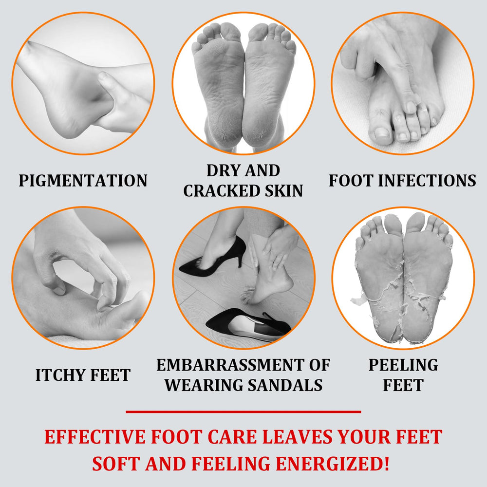 XMXueMei Foot Peeling Spray applied to feet showing easy exfoliation and hydration