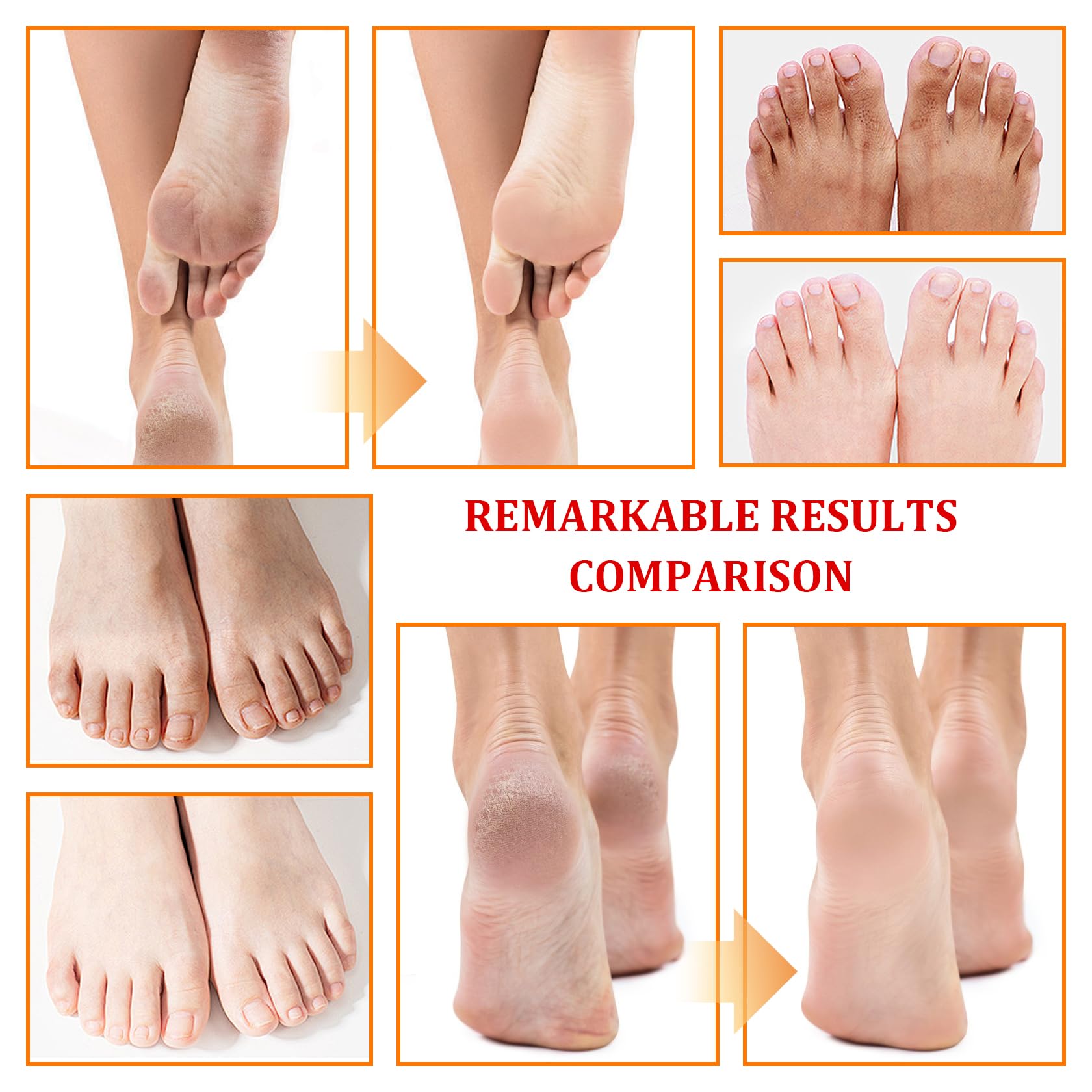 XMXueMei Portable spray design ideal for travel or home foot care